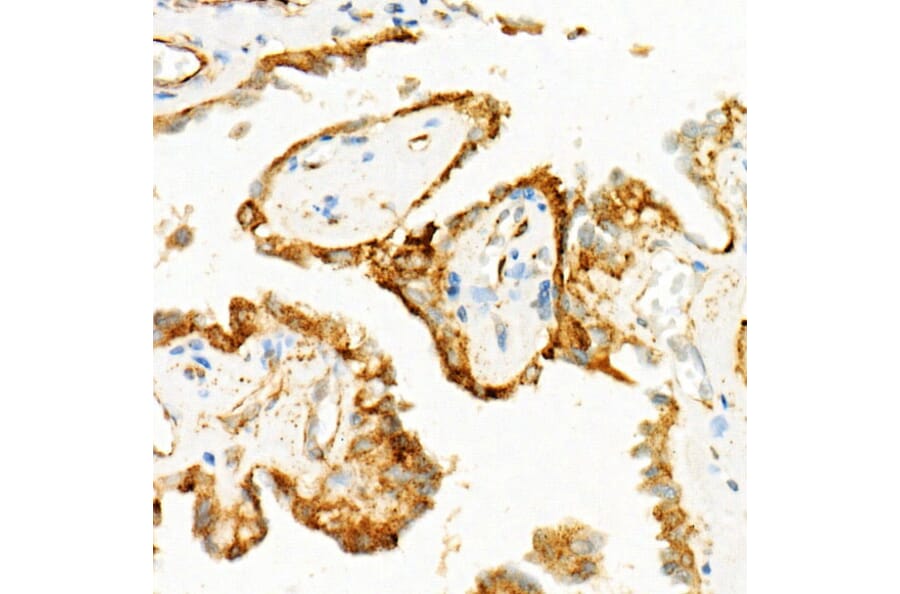 Immunohistochemistry - Anti-Cleaved GSDMD Antibody [ARC57994] (A306734) - Antibodies.com