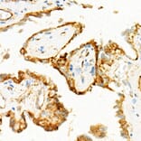 Immunohistochemistry - Anti-Cleaved GSDMD Antibody [ARC57994] (A306734) - Antibodies.com