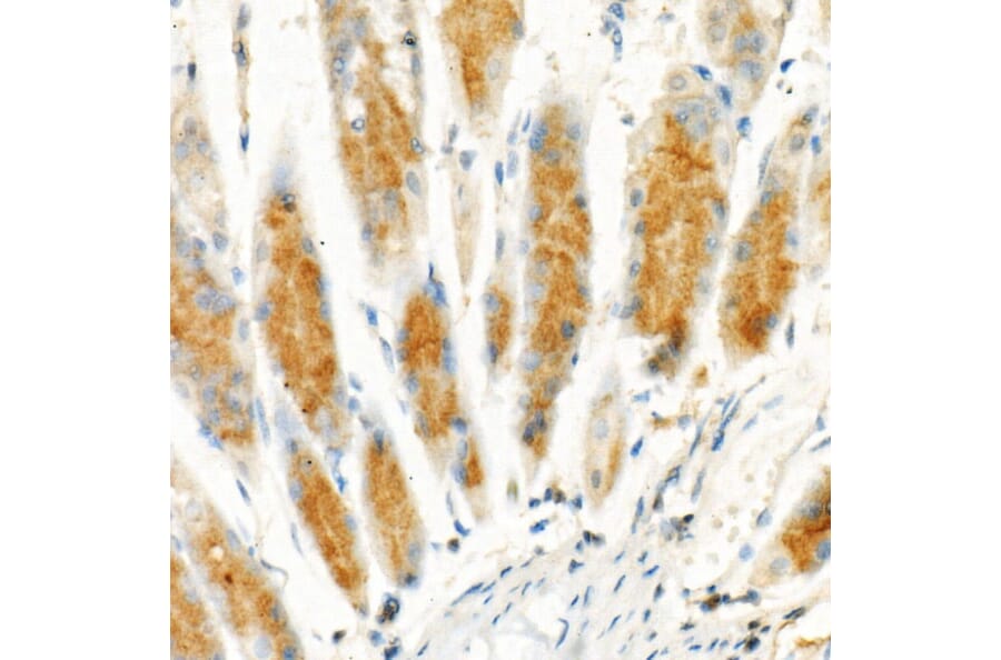Immunohistochemistry - Anti-Cleaved GSDMD Antibody [ARC57994] (A306734) - Antibodies.com