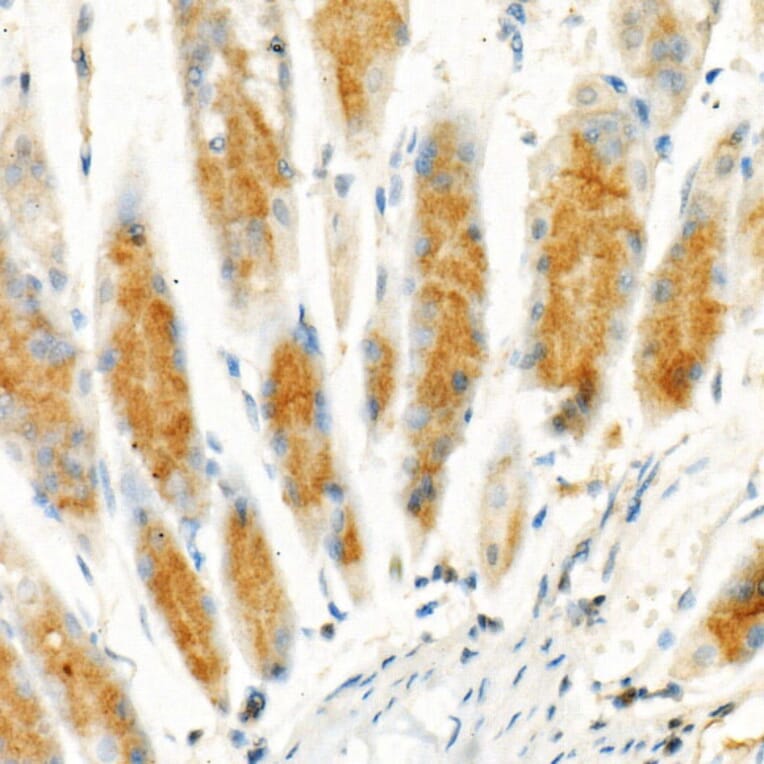 Immunohistochemistry - Anti-Cleaved GSDMD Antibody [ARC57994] (A306734) - Antibodies.com