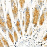 Immunohistochemistry - Anti-Cleaved GSDMD Antibody [ARC57994] (A306734) - Antibodies.com
