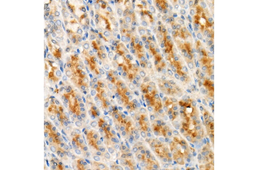 Immunohistochemistry - Anti-Cleaved GSDMD Antibody [ARC57994] (A306734) - Antibodies.com