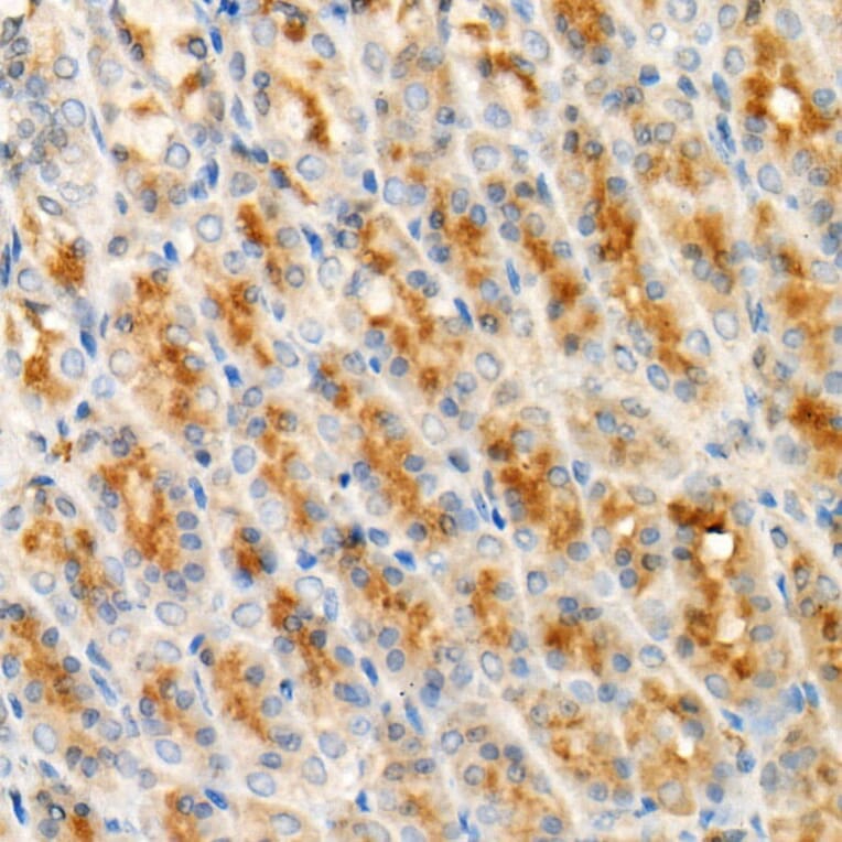 Immunohistochemistry - Anti-Cleaved GSDMD Antibody [ARC57994] (A306734) - Antibodies.com