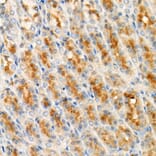 Immunohistochemistry - Anti-Cleaved GSDMD Antibody [ARC57994] (A306734) - Antibodies.com