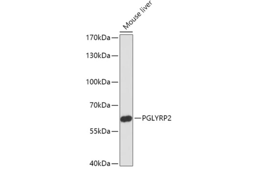Western Blot - Anti-PGLYRP2 Antibody (A306735) - Antibodies.com