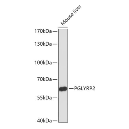 Western Blot - Anti-PGLYRP2 Antibody (A306735) - Antibodies.com