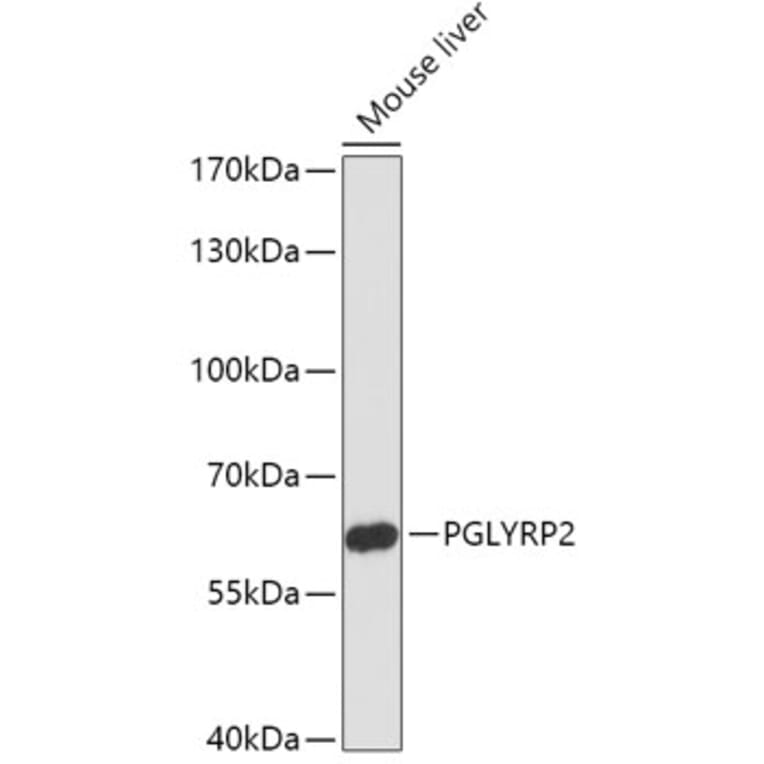 Western Blot - Anti-PGLYRP2 Antibody (A306735) - Antibodies.com