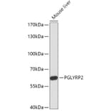 Western Blot - Anti-PGLYRP2 Antibody (A306735) - Antibodies.com