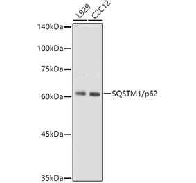 Western Blot - Anti-SQSTM1 / p62 Antibody [ARC0180] (A306736) - Antibodies.com