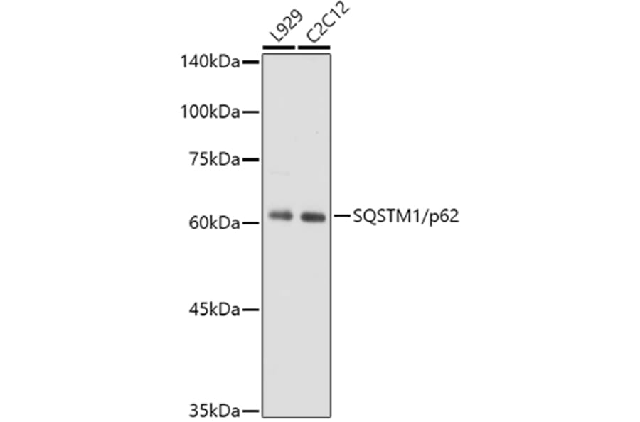 Western Blot - Anti-SQSTM1/p62 Antibody [ARC0180] (A306736) - Antibodies.com
