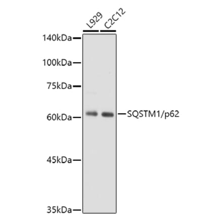 Western Blot - Anti-SQSTM1 / p62 Antibody [ARC0180] (A306736) - Antibodies.com