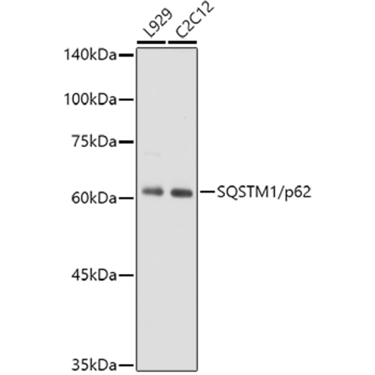 Western Blot - Anti-SQSTM1 / p62 Antibody [ARC0180] (A306736) - Antibodies.com