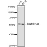 Western Blot - Anti-SQSTM1 / p62 Antibody [ARC0180] (A306736) - Antibodies.com