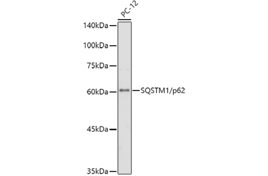 Western Blot - Anti-SQSTM1/p62 Antibody [ARC0180] (A306736) - Antibodies.com