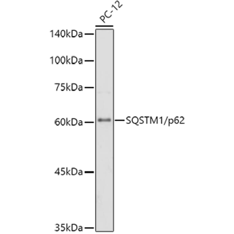 Western Blot - Anti-SQSTM1 / p62 Antibody [ARC0180] (A306736) - Antibodies.com