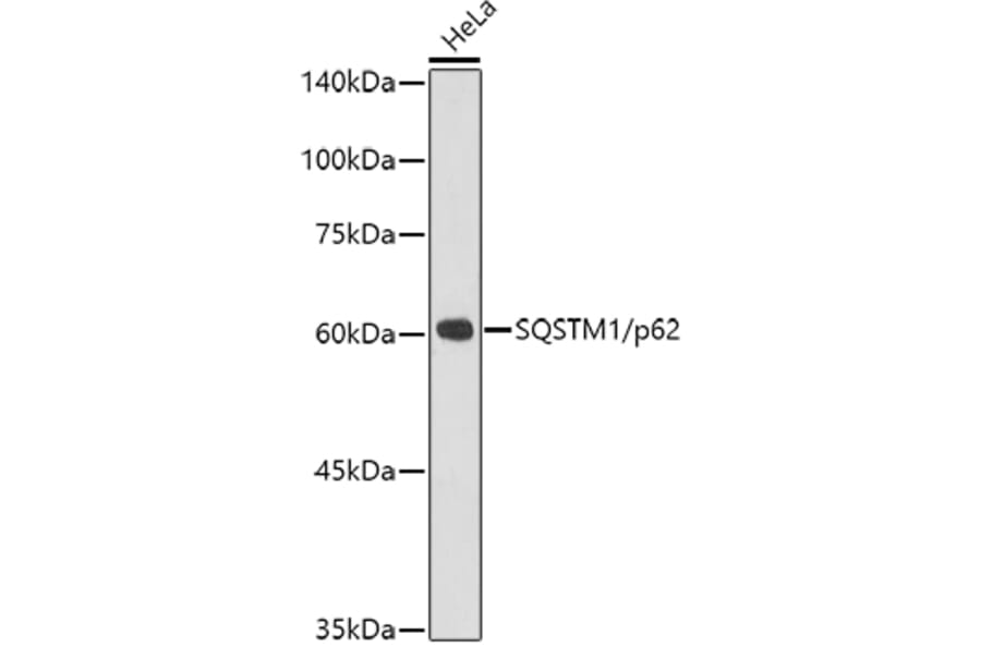 Western Blot - Anti-SQSTM1/p62 Antibody [ARC0180] (A306736) - Antibodies.com
