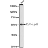 Western Blot - Anti-SQSTM1 / p62 Antibody [ARC0180] (A306736) - Antibodies.com