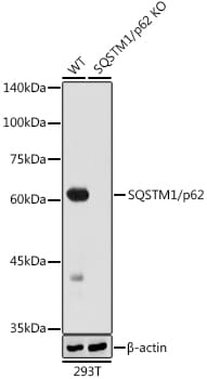 Anti-SQSTM1/p62 Antibody [ARC0180] (A306736) | Antibodies.com