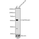 Western Blot - Anti-SQSTM1 / p62 Antibody [ARC0180] (A306736) - Antibodies.com