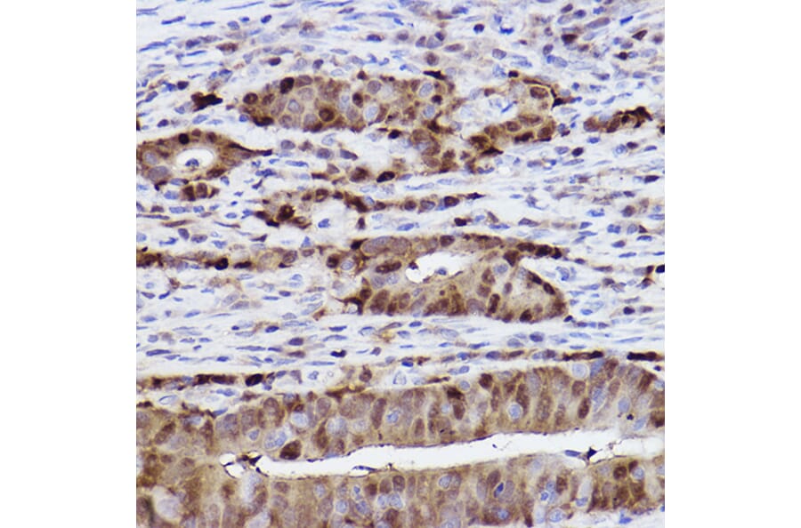 Immunohistochemistry - Anti-SQSTM1/p62 Antibody [ARC0180] (A306736) - Antibodies.com