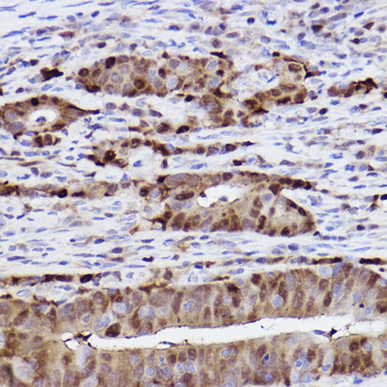 Immunohistochemistry - Anti-SQSTM1 / p62 Antibody [ARC0180] (A306736) - Antibodies.com