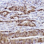 Immunohistochemistry - Anti-SQSTM1 / p62 Antibody [ARC0180] (A306736) - Antibodies.com