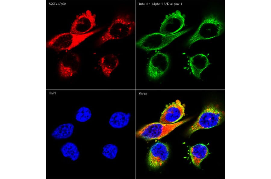 Immunofluorescence - Anti-SQSTM1/p62 Antibody [ARC0180] (A306736) - Antibodies.com