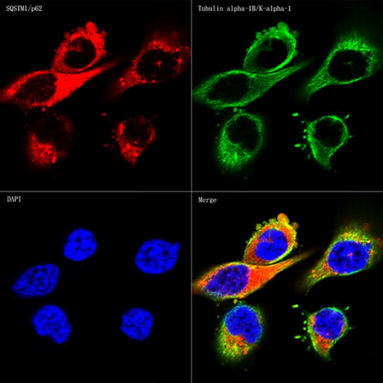 Immunofluorescence - Anti-SQSTM1 / p62 Antibody [ARC0180] (A306736) - Antibodies.com