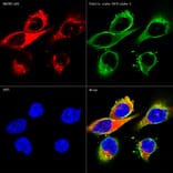 Immunofluorescence - Anti-SQSTM1 / p62 Antibody [ARC0180] (A306736) - Antibodies.com