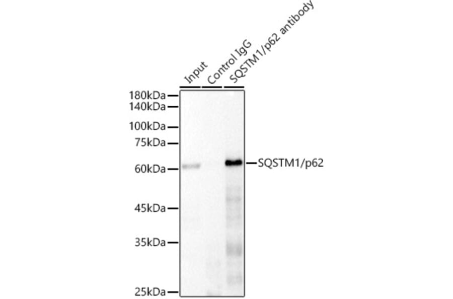 Western Blot - Anti-SQSTM1/p62 Antibody [ARC0180] (A306736) - Antibodies.com