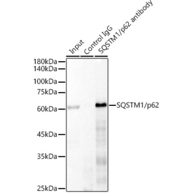 Western Blot - Anti-SQSTM1 / p62 Antibody [ARC0180] (A306736) - Antibodies.com