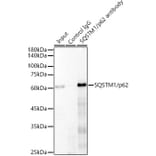 Western Blot - Anti-SQSTM1 / p62 Antibody [ARC0180] (A306736) - Antibodies.com