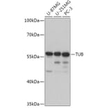 Western Blot - Anti-TUB 1 Antibody (A306737) - Antibodies.com