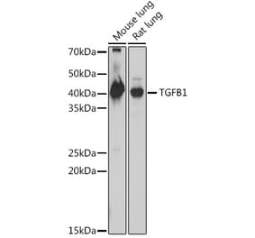 Western Blot - Anti-TGF beta 1 Antibody (A306738) - Antibodies.com