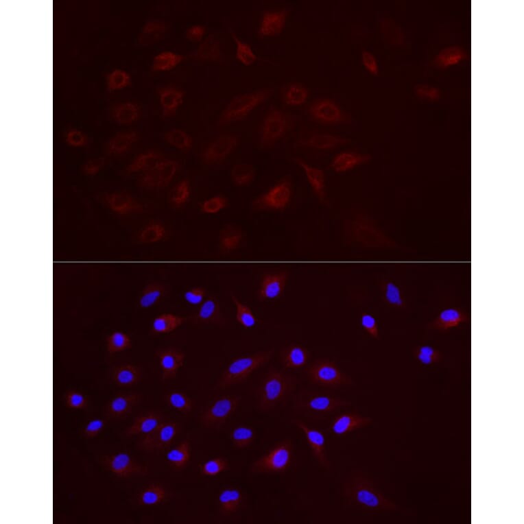 Immunofluorescence - Anti-TGF beta 1 Antibody (A306738) - Antibodies.com