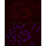 Immunofluorescence - Anti-TGF beta 1 Antibody (A306738) - Antibodies.com