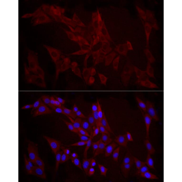 Immunofluorescence - Anti-TGF beta 1 Antibody (A306738) - Antibodies.com