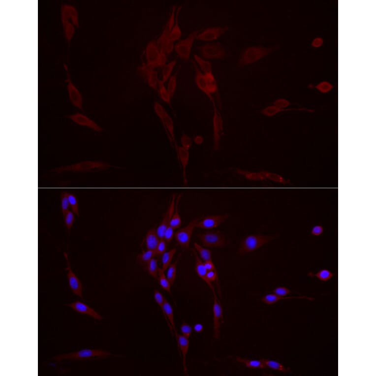 Immunofluorescence - Anti-TGF beta 1 Antibody (A306738) - Antibodies.com