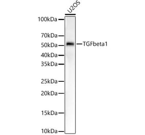 Western Blot - Anti-TGF beta 1 Antibody [ARC57012] (A306739) - Antibodies.com