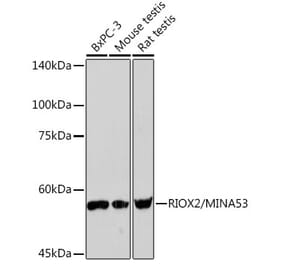 Western Blot - Anti-ROX Antibody [ARC2336] (A306740) - Antibodies.com