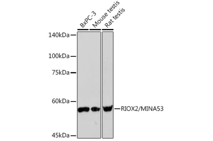Western Blot - Anti-ROX Antibody [ARC2336] (A306740) - Antibodies.com
