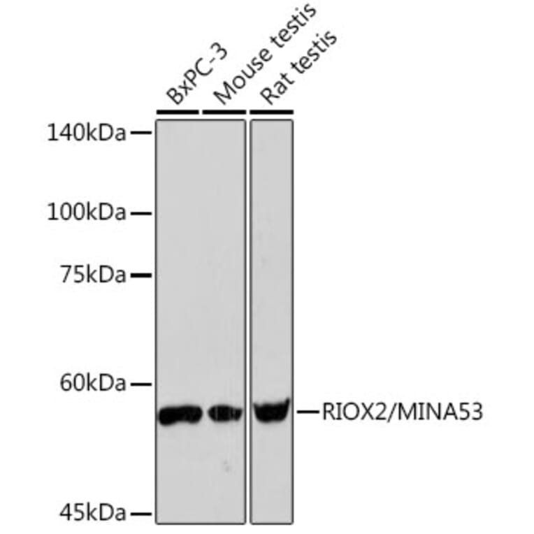 Western Blot - Anti-ROX Antibody [ARC2336] (A306740) - Antibodies.com