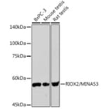 Western Blot - Anti-ROX Antibody [ARC2336] (A306740) - Antibodies.com