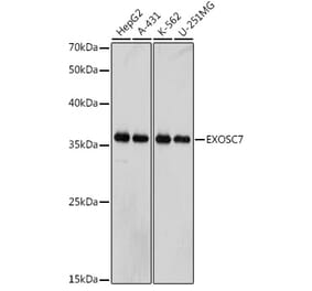 Western Blot - Anti-RRP42 Antibody [ARC2501] (A306741) - Antibodies.com