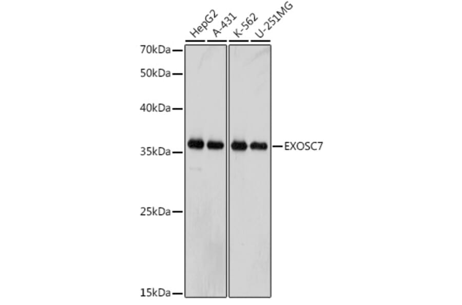 Western Blot - Anti-RRP42 Antibody [ARC2501] (A306741) - Antibodies.com