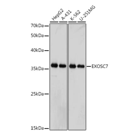 Western Blot - Anti-RRP42 Antibody [ARC2501] (A306741) - Antibodies.com