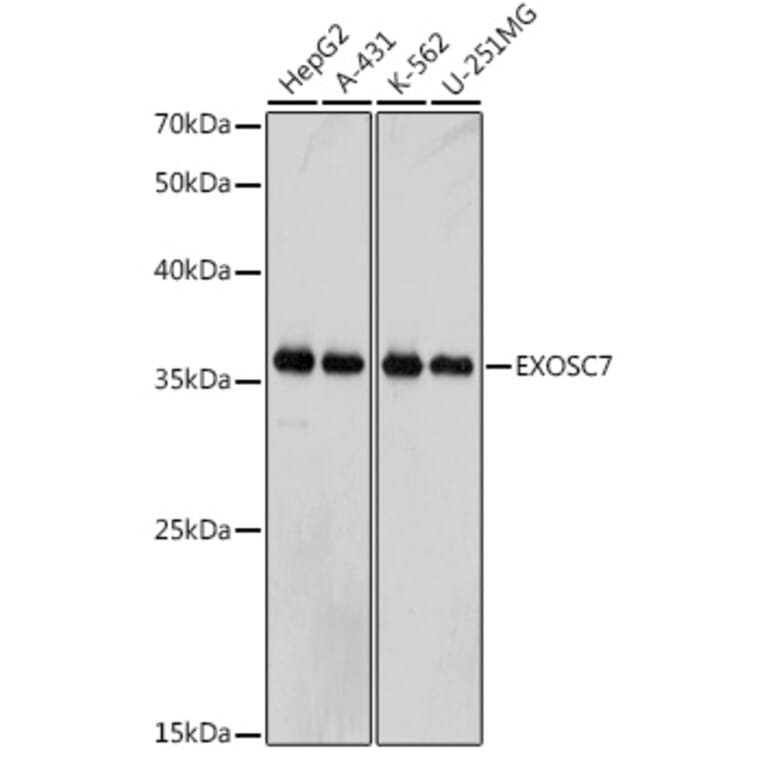 Western Blot - Anti-RRP42 Antibody [ARC2501] (A306741) - Antibodies.com