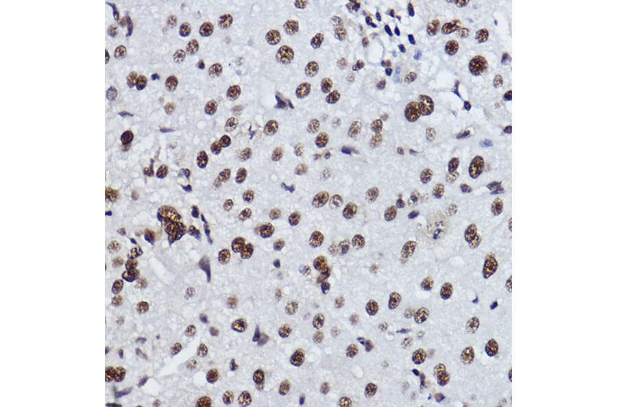 Immunohistochemistry - Anti-RRP42 Antibody [ARC2501] (A306741) - Antibodies.com