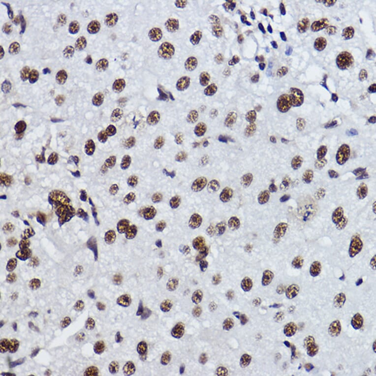 Immunohistochemistry - Anti-RRP42 Antibody [ARC2501] (A306741) - Antibodies.com