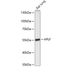 Western Blot - Anti-APLF Antibody (A306743) - Antibodies.com